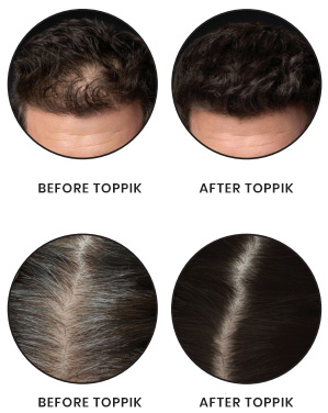 toppik hair fibers